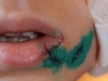 4-летний малыш получил травму на площадке в детском саду