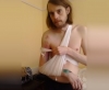 В Калуге участнику акции 5 мая сломали руку при задержании
