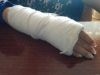 Водитель сломал женщине руку за неправильное перестроение
