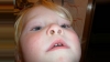 Калужские медики не смогли оказать помощь 3-летней девочке, засунувшей камень в нос 
