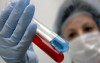 В Калужской области от свиного гриппа скончались 8 человек