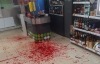 В Калуге 16-летняя девочка пырнула ножом продавщицу и ограбила магазин